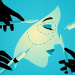 plastic-surgery south korea